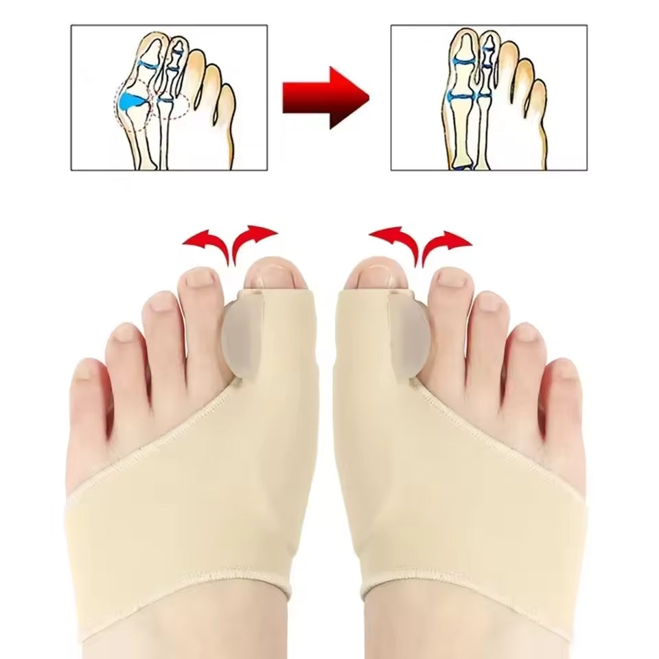 👣 Par de Correctores para Juanetes – ¡Alivio Real para tus Pies!